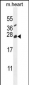 TNFAIP8L2 Antibody (N-term)